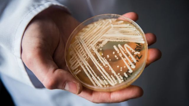 Warning Deadly Fungus Detected in MI, IN, & OH, Spreading Across U.S. (1)